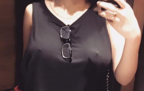 子宫的内膜异位症四期